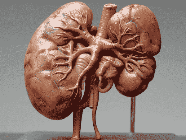  प्रोटीनुरिया किडनी रोग का  आयुर्वेदिक उपचार