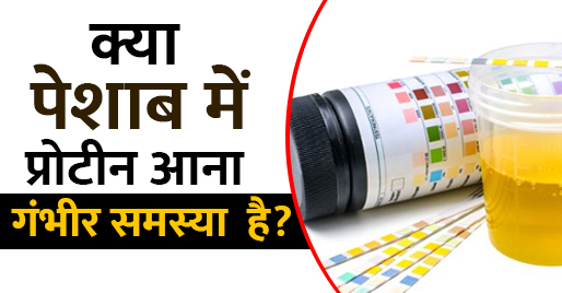 क्या पेशाब में प्रोटीन आना गंभीर समस्या है?