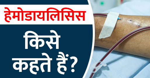 हेमोडायलिसिस किसे कहते हैं?